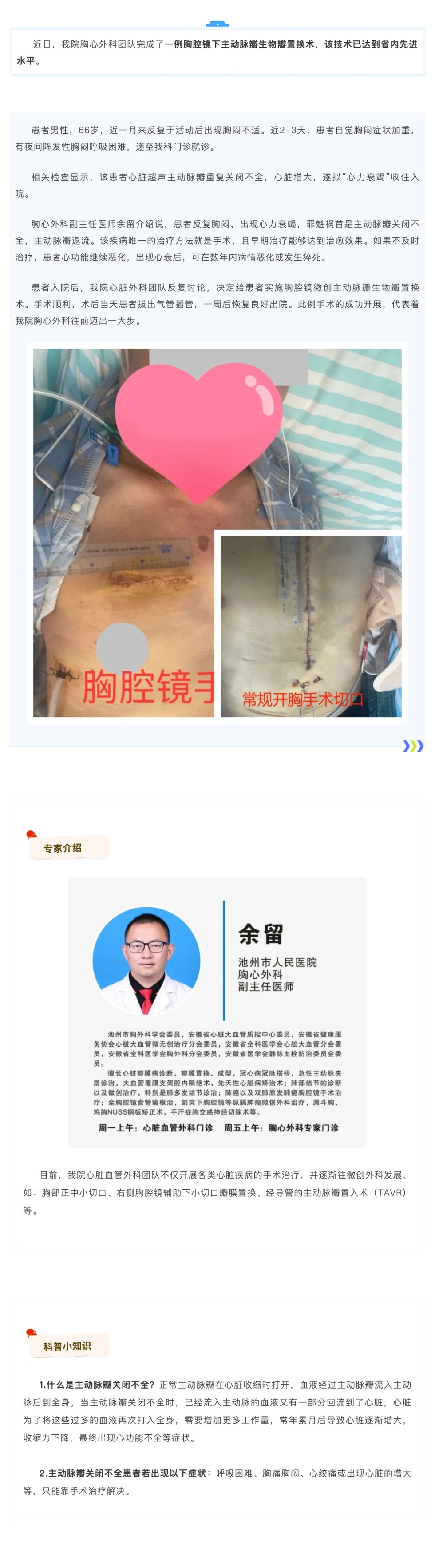 “心”突破！池州市人民医院胸心外科成功实施胸腔镜下主动脉瓣生物瓣置换术_壹伴长图1.jpg