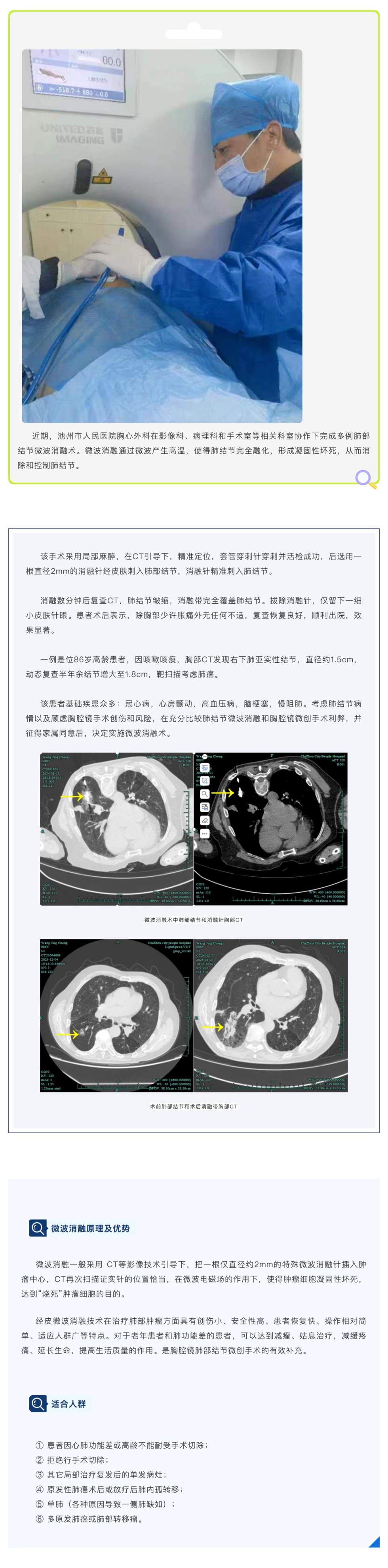 针尖下的艺术：池州市人民医院肺结节微波消融术_壹伴长图1.jpg