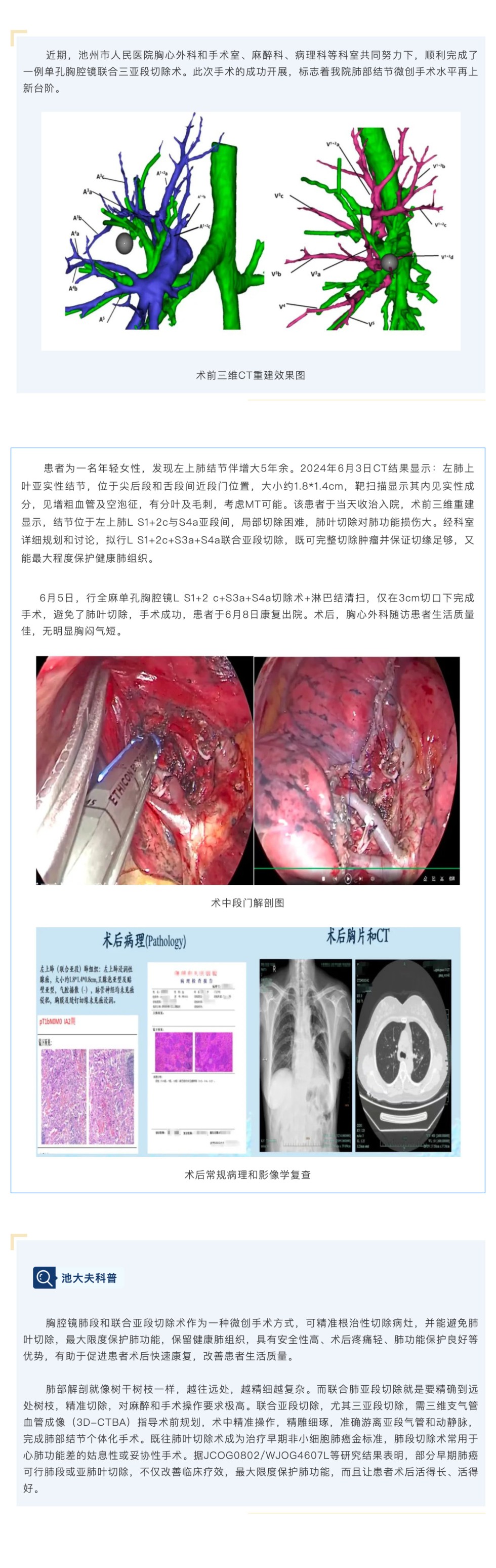 三维重建指引路 精雕细琢除病灶_壹伴长图1.jpg