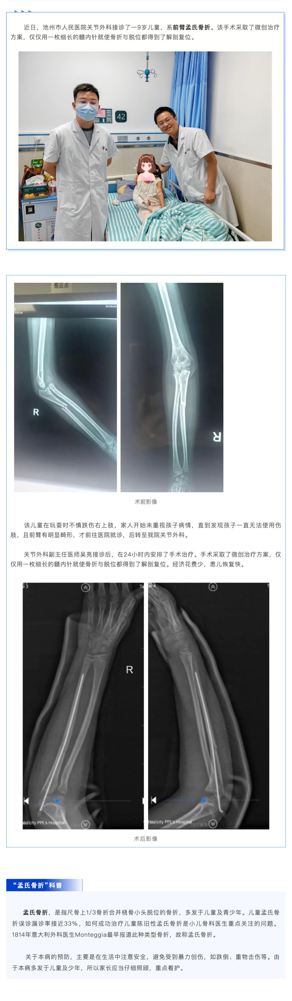 警惕！极易漏诊的儿童骨折：孟氏骨折_壹伴长图1.jpg