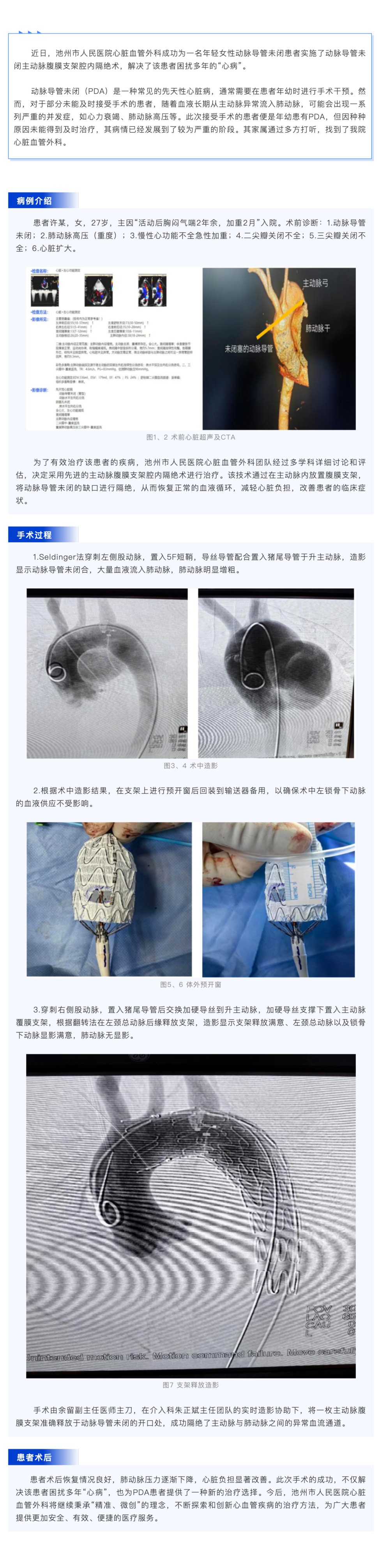 池州市人民医院成功开展动脉导管未闭主动脉腹膜支架腔内隔绝术_壹伴长图1.jpg